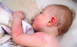 Is there an allergy to cauliflower in babies?