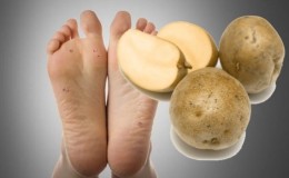 How to get rid of warts with potatoes