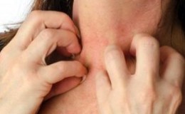 What to do with pumpkin allergy: treat effectively and prevent it in advance