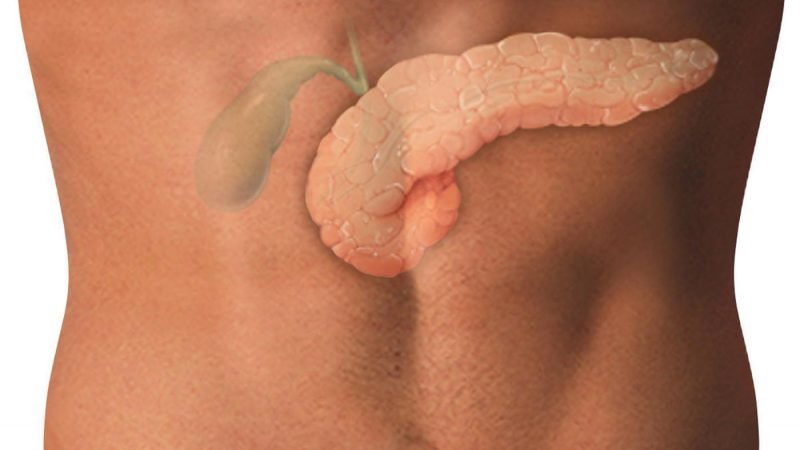Is it possible to eat a melon with cholecystitis and gallstone disease