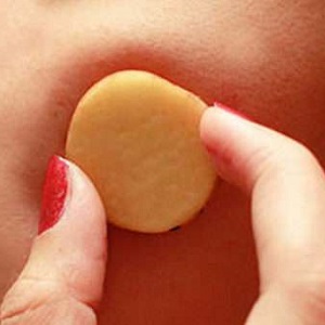 How to get rid of warts with potatoes