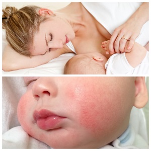 Can you eat potatoes while breastfeeding?