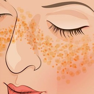 Recipes for making homemade potato face masks for wrinkles