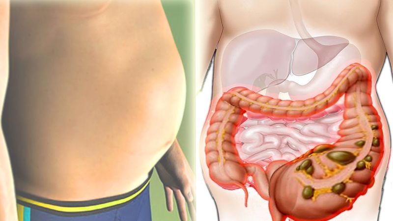 Does potatoes cause gas and why does the stomach swell from it?