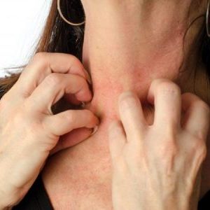 What to do with pumpkin allergy: treat effectively and prevent it in advance