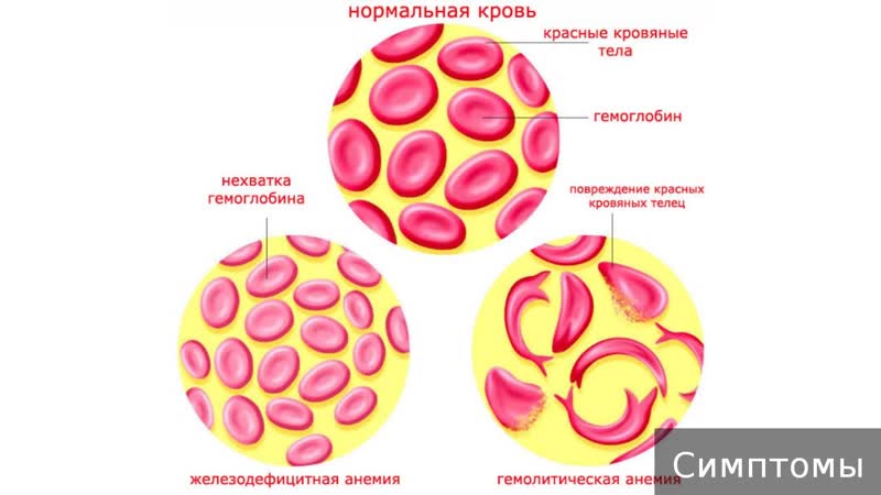 What is the danger of low hemoglobin and how buckwheat increases it