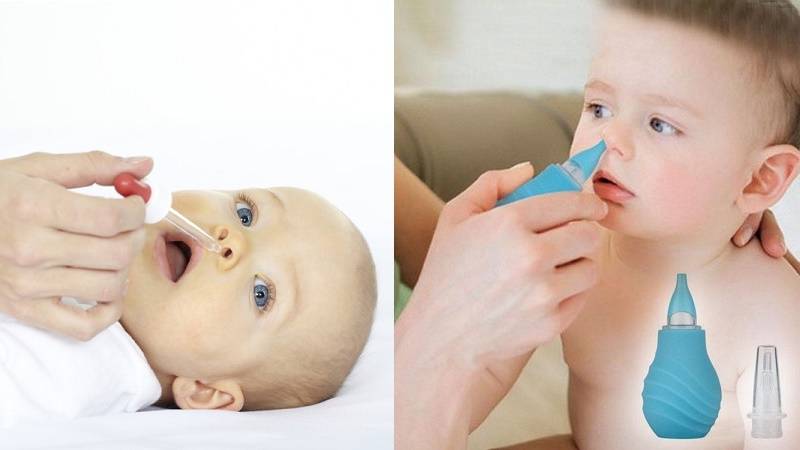 How to use onions to treat a runny nose and nasal congestion in adults