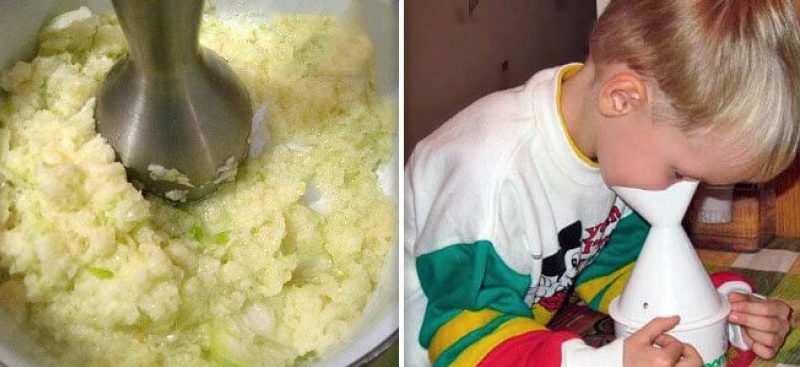 How to use onions to treat a runny nose and nasal congestion in adults