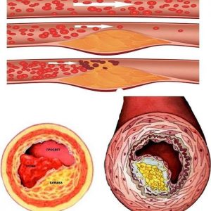 How to cure 100 diseases: the use of onion peels in traditional medicine