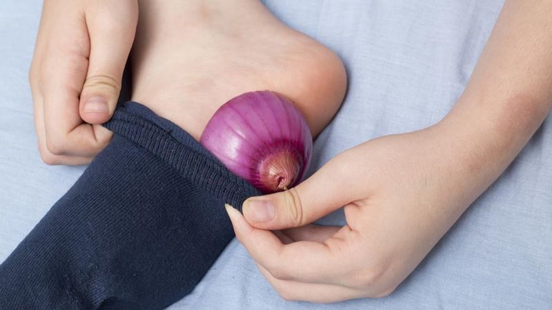 Using onions in socks for medicinal purposes