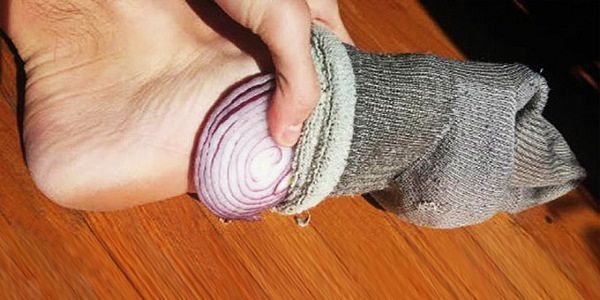 Using onions in socks for medicinal purposes