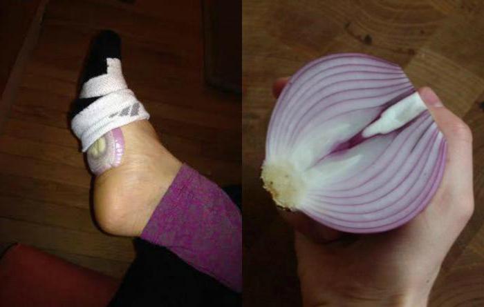 Using onions in socks for medicinal purposes